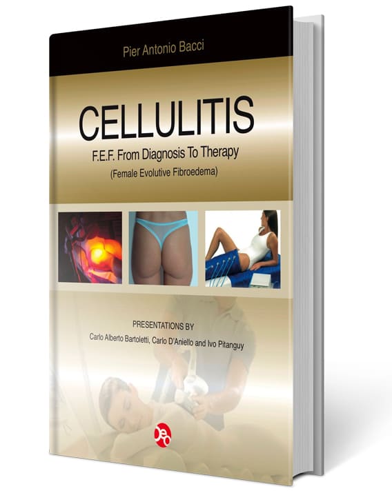 Cellulitis