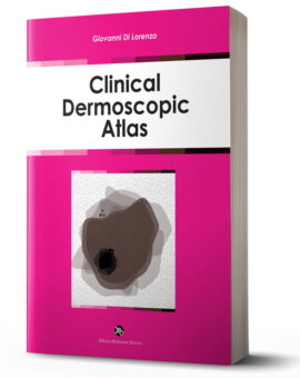 Clinical Dermoscopic Atlas