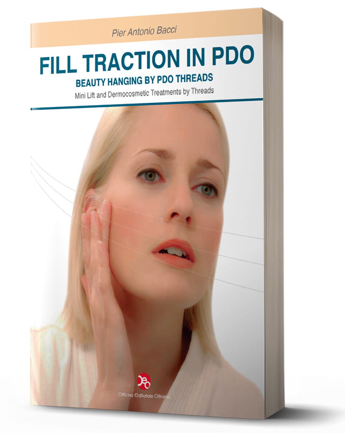 Fill Traction in PDO