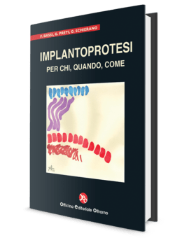 Implantoprotesi