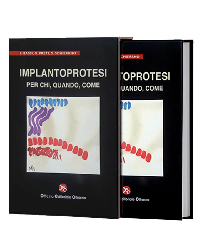 Implantoprotesi - immagine 2