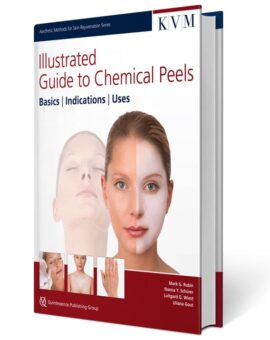Illustrated Guide to Chemical Peels
