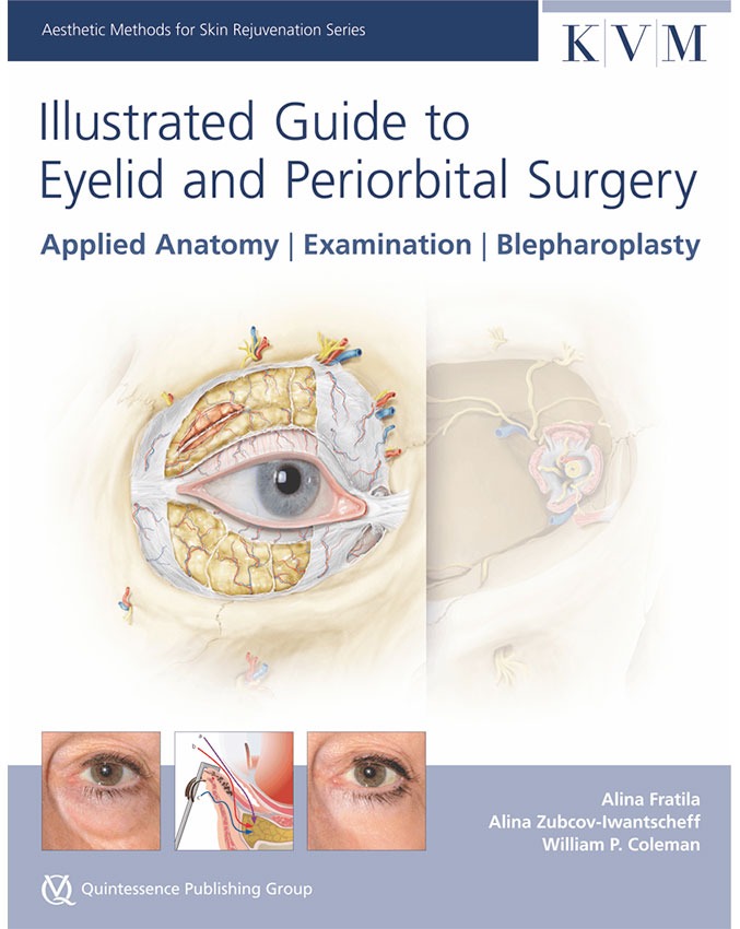 Illustrated Guide to Eyelid and Periorbital Surgery - Image 2