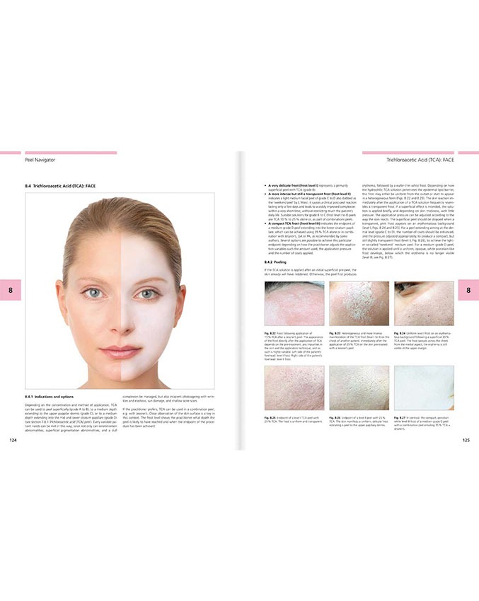 Illustrated Guide to Chemical Peels - Image 3