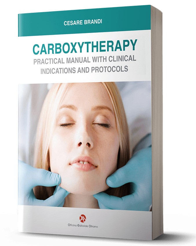 Carboxytherapy - English edition
