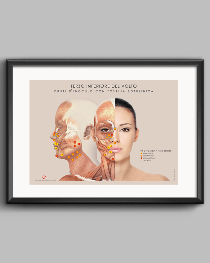 Pacchetto Tossina Botulinica 1 - immagine 6