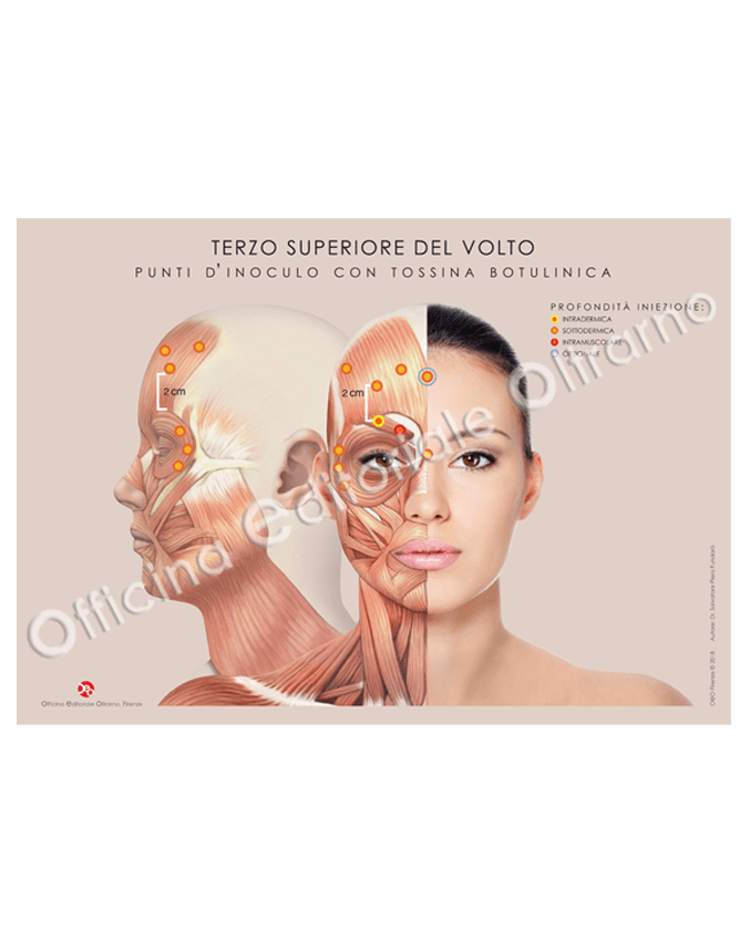 Pacchetto Tossina Botulinica 1 - immagine 3