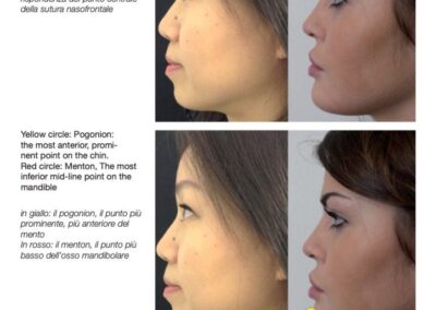 Il K68 e le regole della bellezza