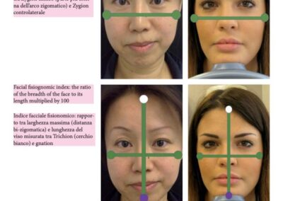 Il K68 e le regole della bellezza