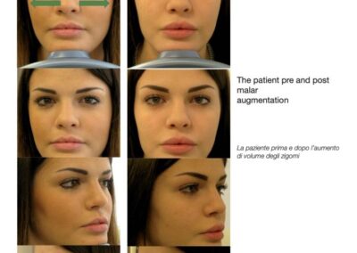 Il K68 e le regole della bellezza