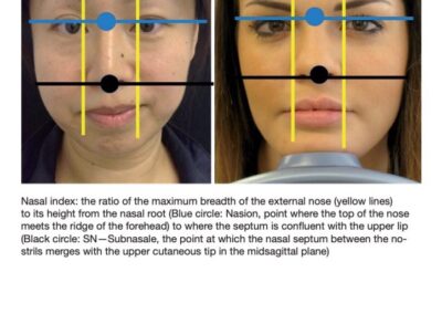 Il K68 e le regole della bellezza