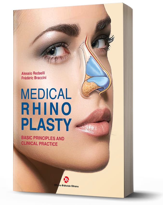 Medical Rhinoplasty - 3rd edition
