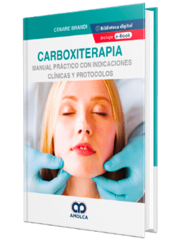 Carboxiterapia - Spanish edition