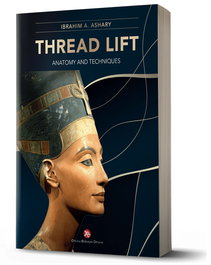 Thread Lift
