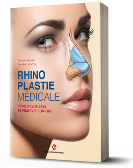 Rhinoplastie Médicale - French Edition