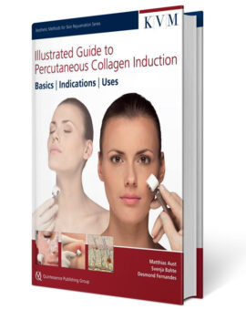 Illustrated Guide to Percutaneous Collagen Induction