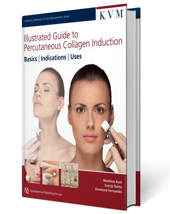 Illustrated Guide to Percutaneous Collagen Induction