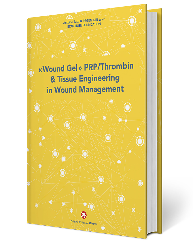 «Wound Gel» PRP/Thrombin & Tissue Engineering in Wound Management